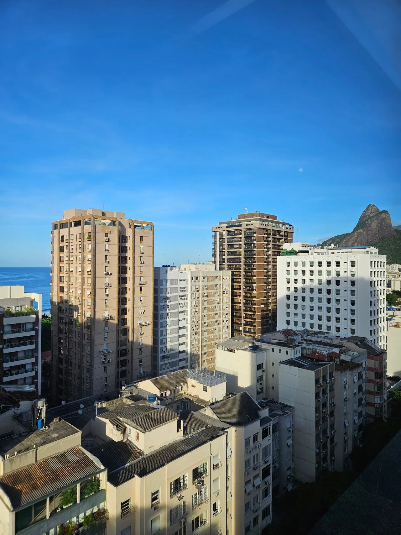 Tratamento Invisalign pela Dra. Glenda Vacchiano, ortodontista certificada em Ipanema